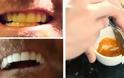 Καταπληκτικό - Αυτός ο άνδρας μας δείχνει πως να λευκάνουμε μόνοι τα δόντια μας - Θα το κάνετε σίγουρα [photos] - Φωτογραφία 1