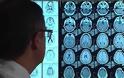 Μελέτη αποκαλύπτει ότι η εγκεφαλική ανάπτυξη επηρεάζεται από το ανοσοποιητικό σύστημα