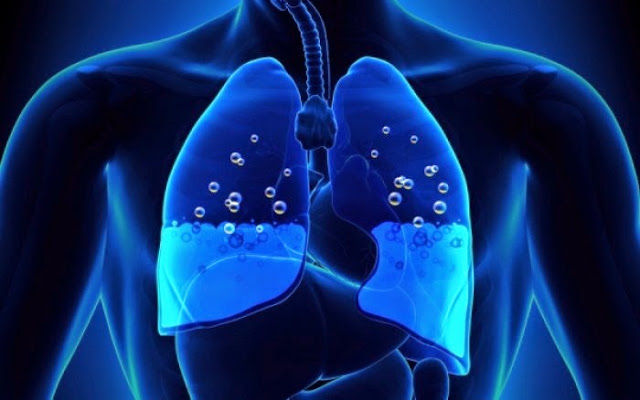Ποια συμπτώματα μπορούν να υποδηλώνουν ότι υπάρχει συσσώρευση υγρού στον πνεύμονα; - Φωτογραφία 1