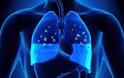Ποια συμπτώματα μπορούν να υποδηλώνουν ότι υπάρχει συσσώρευση υγρού στον πνεύμονα;