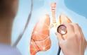 Καρκίνος του πνεύμονα: Πώς μπορεί να συμβεί σε όσους δεν καπνίζουν!