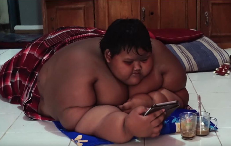 Το πιο χοντρό παιδί του κόσμου (180 κιλά) έχασε 90 κιλάπαιδί - Φωτογραφία 5
