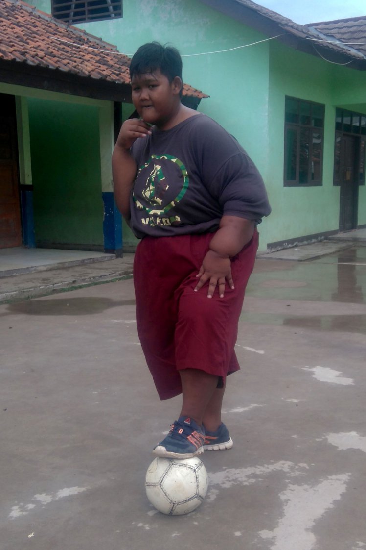 Το πιο χοντρό παιδί του κόσμου (180 κιλά) έχασε 90 κιλάπαιδί - Φωτογραφία 6
