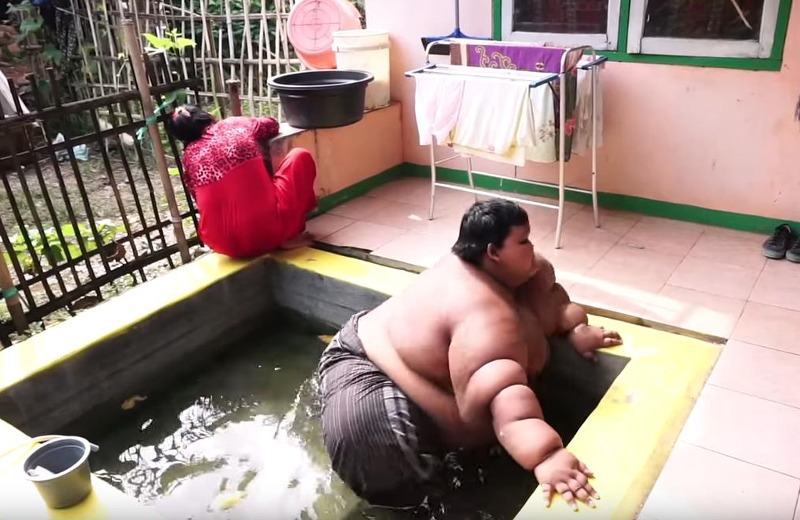 Το πιο χοντρό παιδί του κόσμου (180 κιλά) έχασε 90 κιλάπαιδί - Φωτογραφία 7