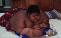 Το πιο χοντρό παιδί του κόσμου (180 κιλά) έχασε 90 κιλάπαιδί - Φωτογραφία 5