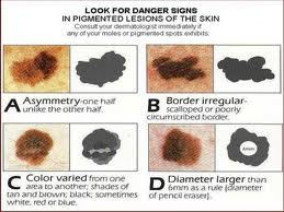 Κάντε το τεστ για να δείτε αν κινδυνεύετε περισσότερο από τον καρκίνο του δέρματος; - Φωτογραφία 4