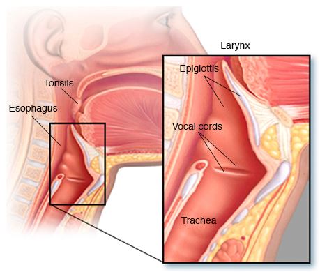 Πότε ο βήχας και ο πονόλαιμος μπορεί να είναι πρώιμα σημάδια καρκίνου του λαιμού; - Φωτογραφία 3