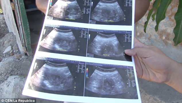 70χρονη ισχυρίζεται ότι είναι έγκυος και περιμένει κοpιτσάκι - Φωτογραφία 3