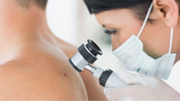 Καρκίνος του δέρματος: Καλύτερη η διάγνωση με την τεχνητή νοημοσύνη λένε οι δερματολόγοι - Φωτογραφία 1