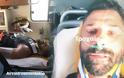 Ταξιτζής χτύπησε και εγκατέλειψε τραυματισμένο τον ηθοποιό Δημήτρη Καμπόλη στο Ικόνιο Περάματος [photos]