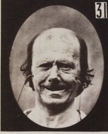 Έρευνα του 1862 δείχνει πως ξεχωρίζει το ψεύτικο χαμόγελο - Φωτογραφία 2