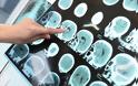 Έλληνες επιστήμονες ελέγχουν την αποτελεσματικότητα της εφαρμογής για την πρόβλεψη του Alzheimer