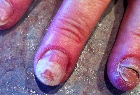 ΣΟΚΑΡΙΣΤΙΚΟ: Τα νύχια αυτής της γυναίκας καταστράφηκαν με κάτι που κάνουν όλες οι γυναίκες [photo] - Φωτογραφία 1