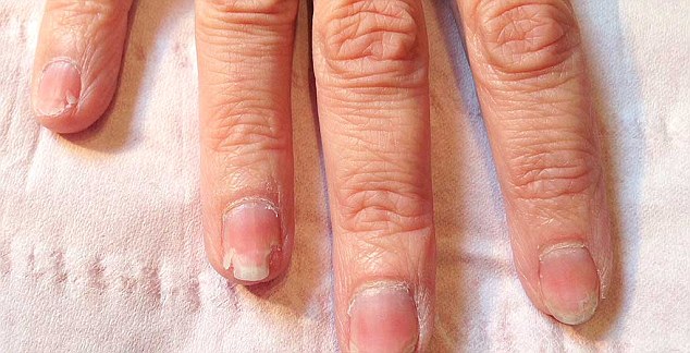 ΣΟΚΑΡΙΣΤΙΚΟ: Τα νύχια αυτής της γυναίκας καταστράφηκαν με κάτι που κάνουν όλες οι γυναίκες [photo] - Φωτογραφία 3