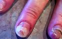 ΣΟΚΑΡΙΣΤΙΚΟ: Τα νύχια αυτής της γυναίκας καταστράφηκαν με κάτι που κάνουν όλες οι γυναίκες [photo]
