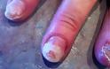 ΣΟΚΑΡΙΣΤΙΚΟ: Τα νύχια αυτής της γυναίκας καταστράφηκαν με κάτι που κάνουν όλες οι γυναίκες [photo] - Φωτογραφία 2