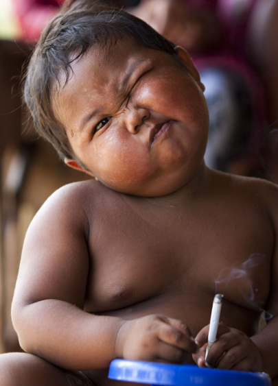Θυμάστε το 2χρονο αγοράκι που κάπνιζε μανιωδώς, 40 τσιγάρα την ημέρα; - Δείτε πως είναι σήμερα και τι κάνει [photos] - Φωτογραφία 3