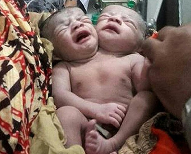 Δείτε τι γέννησε μια γυναίκα στο Μπακλαντές... - Φωτογραφία 2