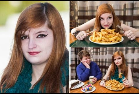 ΑΠΙΣΤΕΥΤΟ! 17χρονη έτρωγε κάθε μέρα για 5 χρόνια μόνο πατάτες τηγανητές! Δείτε τι έπαθε... [photo] - Φωτογραφία 1