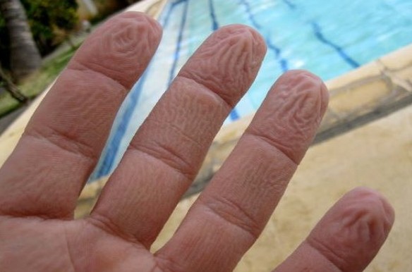 Γιατί ζαρώνουν τα δάχτυλά σας μέσα στο νερό – Όχι, δεν είναι επειδή «μούλιασαν»… - Φωτογραφία 1