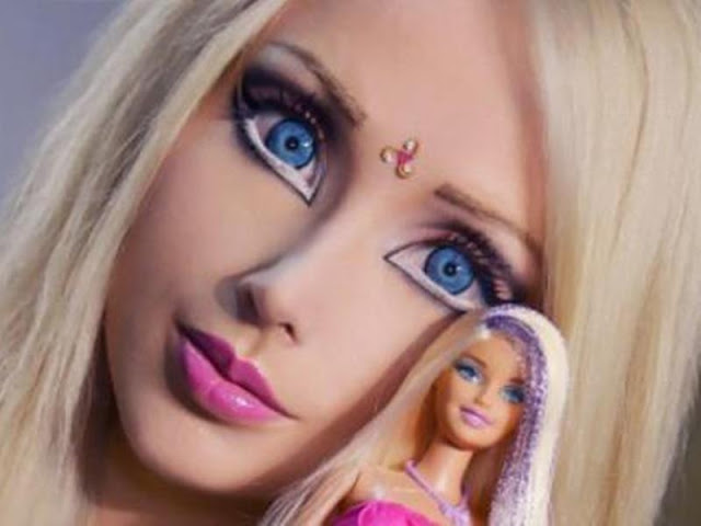 Σύνδρομο Barbie: Τι είναι και γιατί ανησυχεί τους γιατρούς; - Φωτογραφία 2