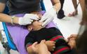 Συναγερμός στην Παπούα Νέα Γουινέα: Επανεμφανίστηκε η πολιομυελίτιδα