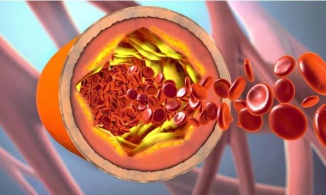Τι είναι η χοληστερόλη και πώς την χρησιμοποιεί ο οργανισμός – Πότε υπάρχει πρόβλημα (Video) - Φωτογραφία 1
