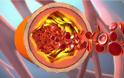 Τι είναι η χοληστερόλη και πώς την χρησιμοποιεί ο οργανισμός – Πότε υπάρχει πρόβλημα (Video)
