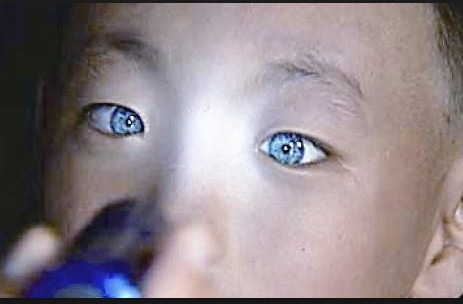 Το αγόρι που τρέλανε την επιστημονική κοινότητα: Έχει την ικανότητα να βλέπει στο απόλυτο… σκοτάδι με μάτια που λάμπουν! [video] - Φωτογραφία 1