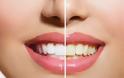 Τα καλύτερα tricks για λευκά δόντια