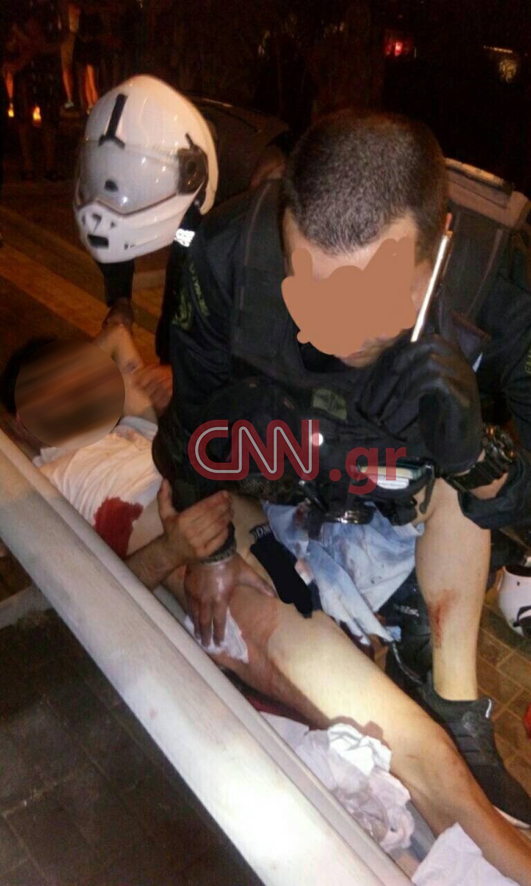 Άγρια συμπλοκή με έναν σοβαρά τραυματία στη Βάρκιζα - Φωτογραφία 3