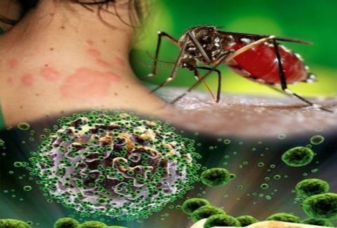 Ιος Δυτικού Νείλου: Αυξάνονται τα κρούσματα, ποια είναι τα συμπτώματα μετά το τσίμπημα των κουνουπιών - Φωτογραφία 1