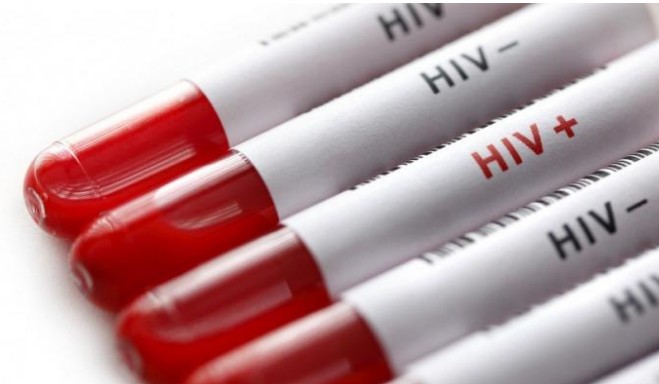 Ελπίδα από νέο εμβόλιο κατά του HIV - Τα πρώτα σημαντικά ευρήματα των δοκιμών - Φωτογραφία 1