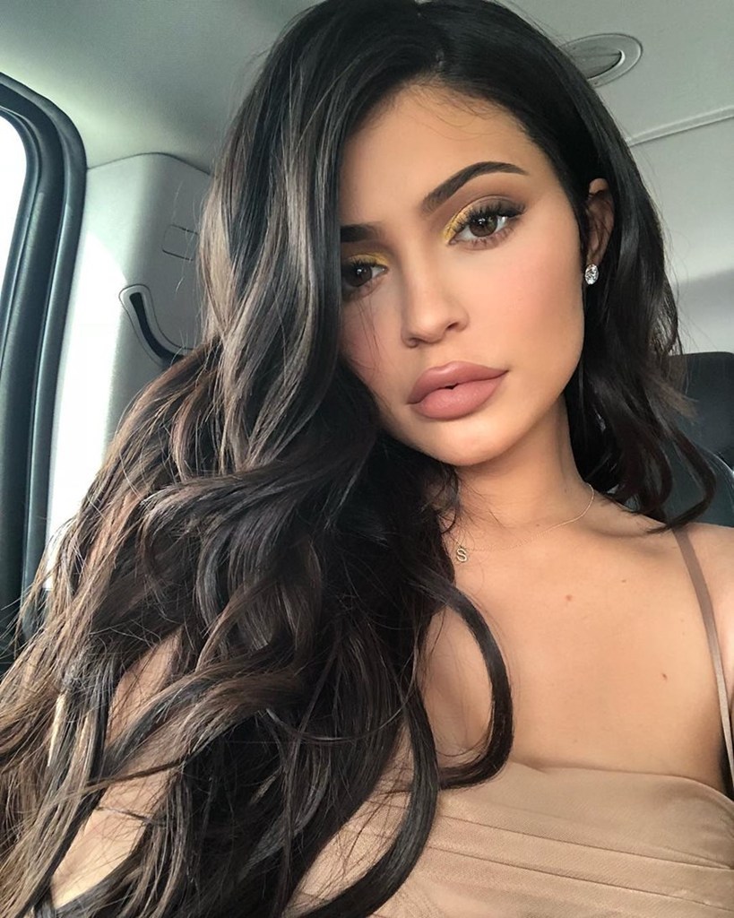 Η Kylie Jenner αφαίρεσε τα εμφυτεύματα από τα χείλη της και το αποτέλεσμα είναι μοναδικό! - Φωτογραφία 2