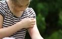 Τα κουνούπια δεν πάνε διακοπές: Τρόποι προστασίας για τα παιδιά