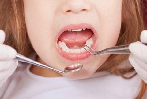 ΣΟΚΑΡΙΣΤΙΚΟ: Δεν φαντάζεστε πόσα δόντια είχε ένα 7χρονο κοριτσάκι μέσα στο στόμα του [photo] - Φωτογραφία 1