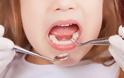 ΣΟΚΑΡΙΣΤΙΚΟ: Δεν φαντάζεστε πόσα δόντια είχε ένα 7χρονο κοριτσάκι μέσα στο στόμα του [photo] - Φωτογραφία 1
