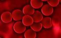Ρουξολιτινίμπη: Μειώνει τον κίνδυνο θανάτου σε ασθενείς με αληθή πολυκυτταραιμία