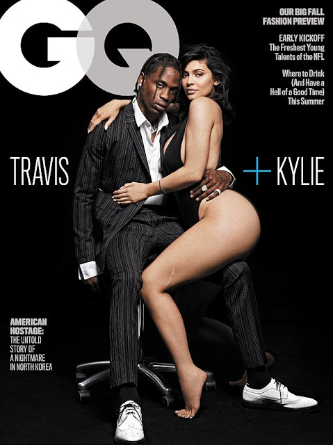Η Kylie Jenner αποκάλυψε την ιστορία πίσω από την τεράστια ουλή στο αριστερό της πόδι - Φωτογραφία 2