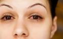Αλλεργία στα μάτια: Αντιμετώπιση για φαγούρα, κοκκίνισμα και δάκρυα [video]
