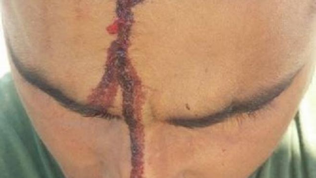 Αχαΐα: Χτύπησε με αξίνα στο κεφάλι εργάτη γιατί ζήτησε τα δεδουλευμένα του - Φωτογραφία 1