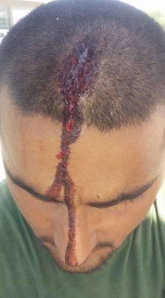 Αχαΐα: Χτύπησε με αξίνα στο κεφάλι εργάτη γιατί ζήτησε τα δεδουλευμένα του - Φωτογραφία 2