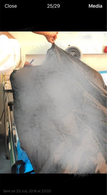 Η φωτογραφία-ντοκουμέντο για την ώρα που το πρώτο πτώμα από το Mάτι μεταφέρθηκε στο Σισμανόγλειο - Φωτογραφία 2