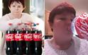 Πίνει 6 Λίτρα Coca cola τη μέρα - Το αποτέλεσμα; Θα σας σοκάρει... [photos]