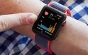 Οι ιδιοκτήτες του Apple Watch άρχισαν να λαμβάνουν ειδοποίηση για την ολοκλήρωση της μελέτης της Apple Heart