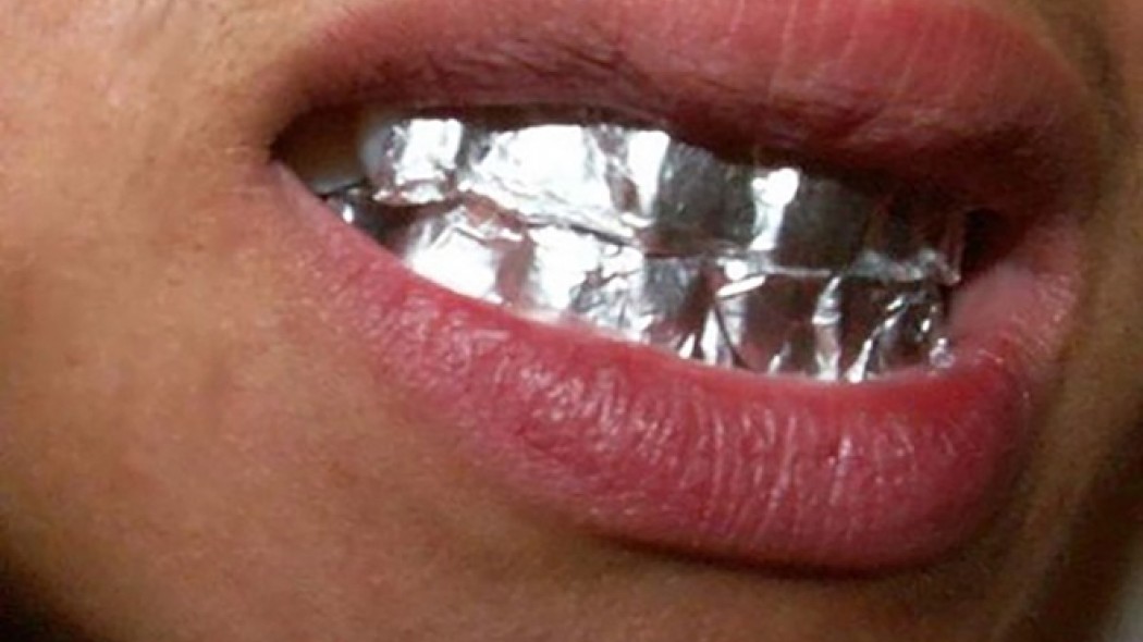 Φοβερό: Ξέρετε τι θα συμβεί, αν βάλετε φύλλο αλουμινίου στα δόντια σας για 1 ώρα; - Φωτογραφία 1