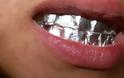 Φοβερό: Ξέρετε τι θα συμβεί, αν βάλετε φύλλο αλουμινίου στα δόντια σας για 1 ώρα;