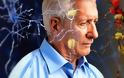 Φάρμακο για την ηπατική νόσο ενδεχομένως δρα θετικά έναντι του Αλτσχάιμερ, σύμφωνα με νέα μελέτη