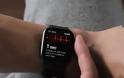 Ο αισθητήρας ECG στο Apple Watch Series 4 θα λειτουργεί μόνο στις ΗΠΑ - Φωτογραφία 3