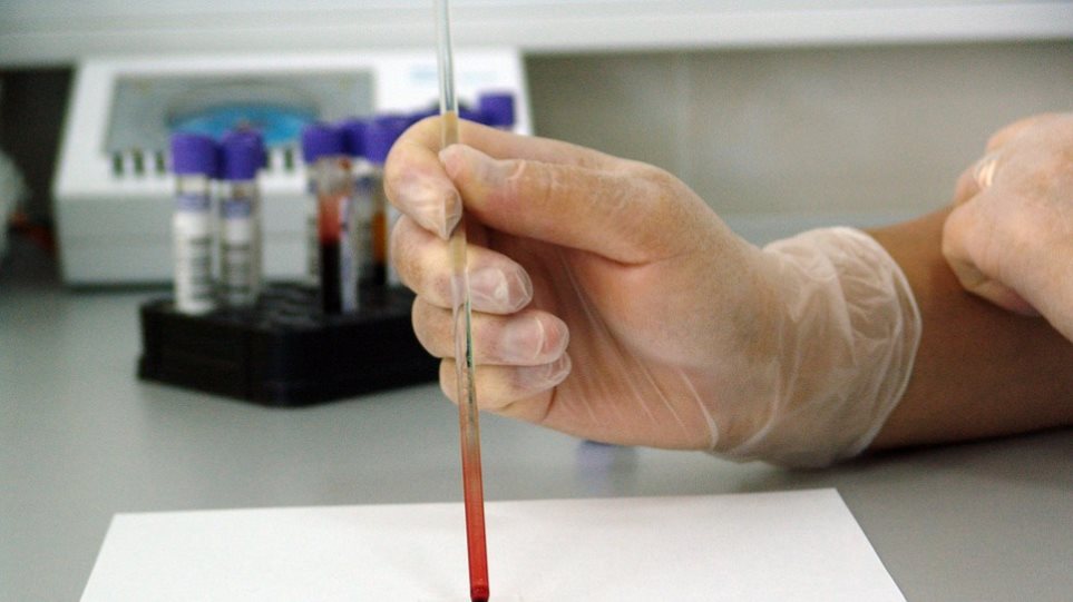 Για πρώτη φορά τεστ αίματος αποκαλύπτει τι ώρα είναι... μέσα στο ανθρώπινο σώμα! - Φωτογραφία 1